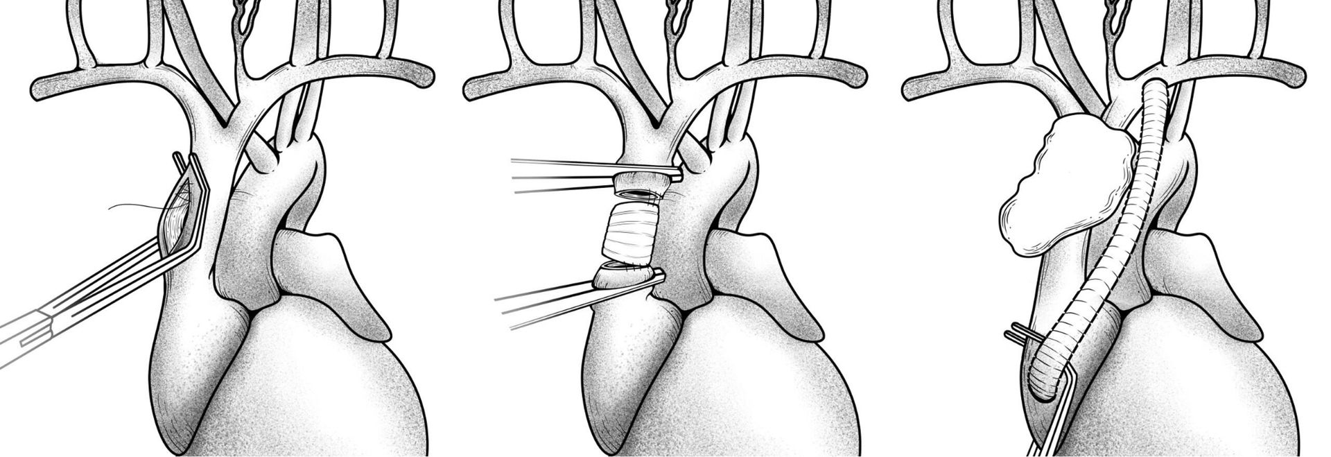 Additional medical illustration
