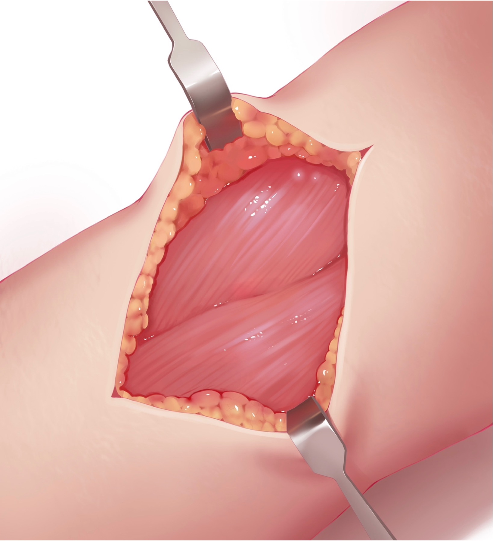 Anatomical detail close-up